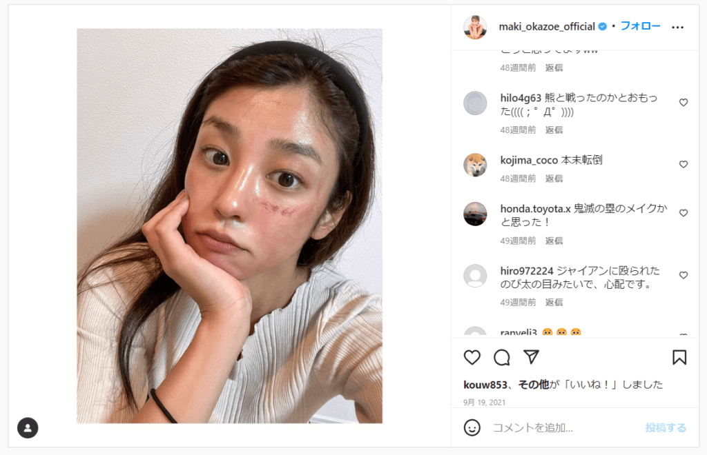 instagram 岡副麻希 ダーマペン